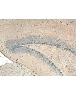 GAT1 Polyclonal antibody 28488-1-AP proteintech