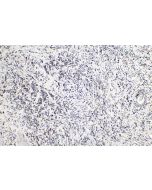 Midkine Polyclonal antibody 28546-1-AP proteintech