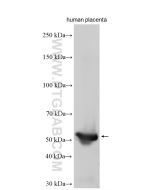 LPL Polyclonal antibody 28602-1-AP proteintech