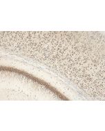 CCSAP Polyclonal antibody 28644-1-AP proteintech