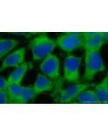 METAP1 Polyclonal antibody 28702-1-AP proteintech