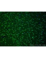 ALG13 Polyclonal antibody 28738-1-AP proteintech