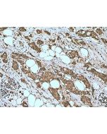 MDMX/MDM4 Polyclonal antibody 28747-1-AP proteintech