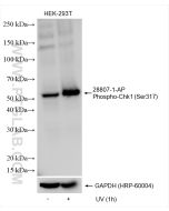 Phospho-Chk1 (Ser317) Polyclonal antibody 28807-1-AP proteintech