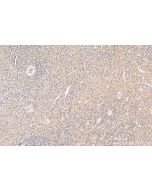 PLA2G4A Polyclonal antibody 28924-1-AP proteintech