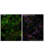 Phospho-RPS6KA1 (Ser380) Polyclonal antibody 28983-1-AP proteintech