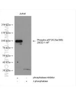 Phospho-eEF2K (Ser366) Polyclonal antibody 29032-1-AP proteintech