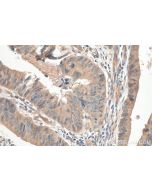 SEMA4B Polyclonal antibody 29191-1-AP proteintech