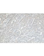 FAM83A Polyclonal antibody 29289-1-AP proteintech
