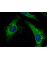 SPATA2 Polyclonal antibody 29321-1-AP proteintech