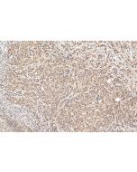 STK11/LKB1 Polyclonal antibody 29323-1-AP proteintech