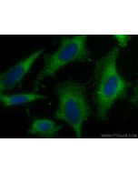 HHIP Polyclonal antibody 29466-1-AP proteintech