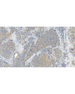 ABCC5 Polyclonal antibody 29792-1-AP proteintech