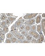 PPP1R13B Polyclonal antibody 29804-1-AP proteintech