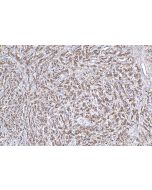 SIRT3 Polyclonal antibody 29838-1-AP proteintech