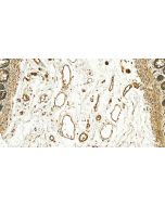 Kindlin 2 Polyclonal antibody 29911-1-AP proteintech