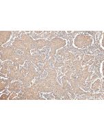 TRPV3 Polyclonal antibody 29971-1-AP proteintech