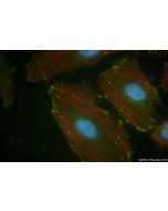 Anti-Human uPAR/CD87 Rabbit Recombinant Antibody Proteintech  98048-1-RR