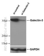 Galectin-3 Polyclonal antibody Proteintech  14979-1-AP
