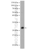 Lipocalin-2/NGAL Polyclonal antibody Proteintech  26991-1-AP
