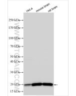 KRAS Polyclonal antibody Proteintech  12063-1-AP