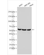 PEX14 Polyclonal antibody Proteintech  10594-1-AP