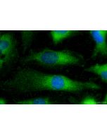 BAK Polyclonal antibody 30017-1-AP proteintech