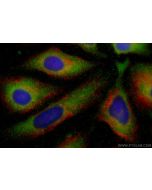 KIAA1797 Polyclonal antibody 30140-1-AP proteintech