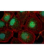 FATS Polyclonal antibody 30190-1-AP proteintech