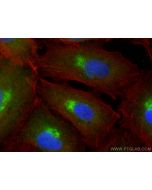 FCGR3B/CD16b Polyclonal antibody 30201-1-AP proteintech