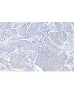 NOTCH3 Polyclonal antibody 30540-1-AP proteintech