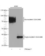 CEACAM6/CD66c Polyclonal antibody 30569-1-AP proteintech