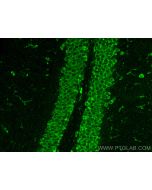 SSR3 Polyclonal antibody 30851-1-AP proteintech
