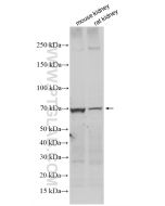 KIM-1/HAVCR1 Polyclonal antibody 30948-1-AP proteintech