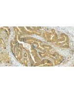 NLRP6 Polyclonal antibody 30973-1-AP proteintech
