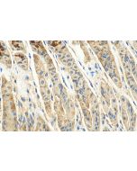 CLPX Polyclonal antibody 31050-1-AP proteintech
