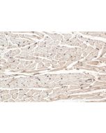 Atox1 Polyclonal antibody 31090-1-AP proteintech