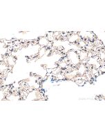 AGER/RAGE Polyclonal antibody 31122-1-AP proteintech