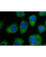 IL-1RA Polyclonal antibody 31127-1-AP proteintech