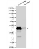 IGFBP7 Polyclonal antibody 31128-1-AP proteintech