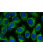 METTL8 Polyclonal antibody 31173-1-AP proteintech