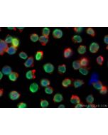 HNRNPAB Polyclonal antibody 31175-1-AP proteintech