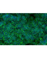 CD45 Polyclonal antibody 31243-1-AP proteintech
