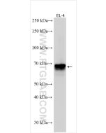 CD5 Polyclonal antibody 31249-1-AP proteintech