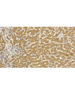 CMIP Polyclonal antibody 31407-1-AP proteintech