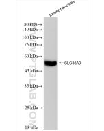 SLC38A9 Recombinant monoclonal antibody Proteintech  83182-5-RR