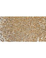E-cadherin Polyclonal antibody 31515-1-AP proteintech