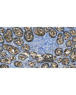 CEA/CD66e Polyclonal antibody 31519-1-AP proteintech