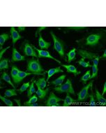 TANC2 Polyclonal antibody 31541-1-AP proteintech