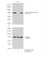 Phospho-SAMHD1 (Thr592) Polyclonal antibody 31597-1-AP proteintech